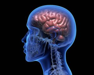 What Are the Symptoms of a Brain Tumor