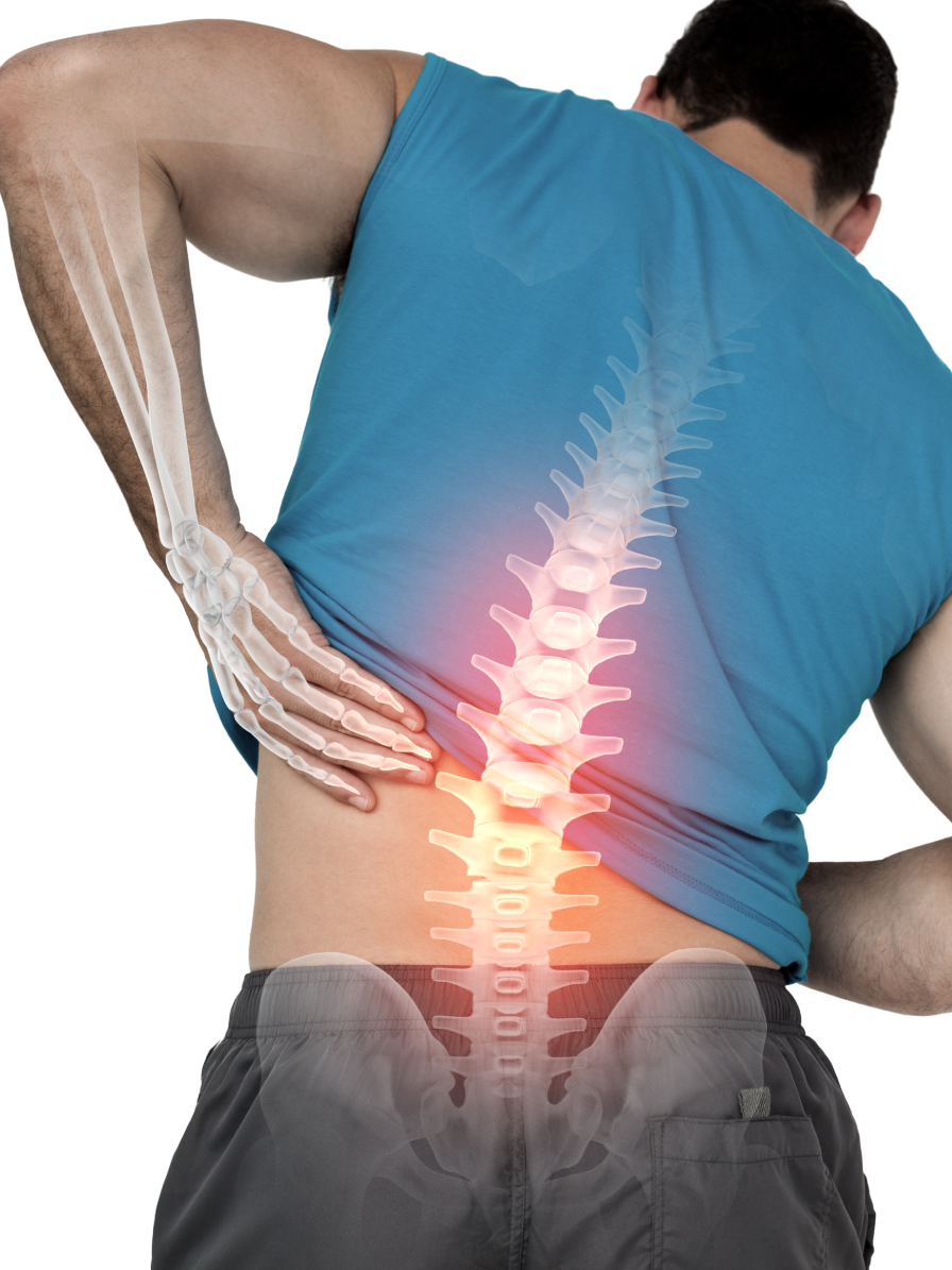What Is Sciatica
